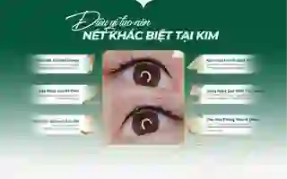 Ưu điểm dịch vụ